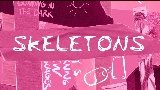 Thumbnail video Skeletons